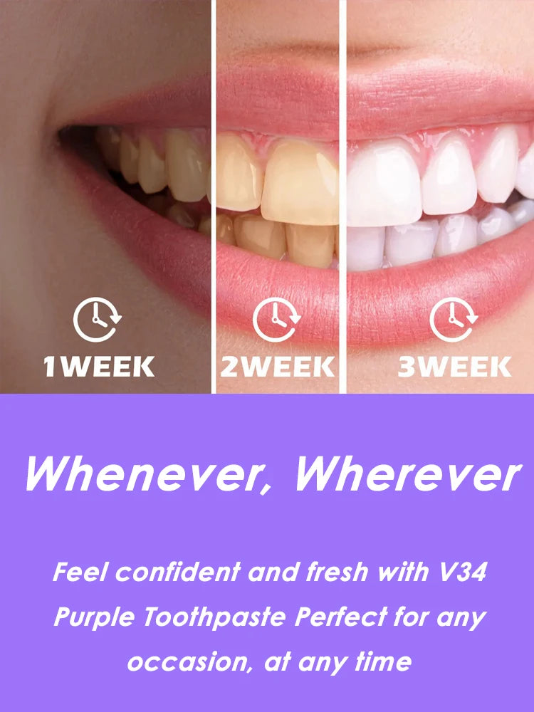 V34 Dental Toothpaste Whitening Instant Teeth Whitener Tooth Stain Tartar Hygiene Fresh Breath Cleaner Oral